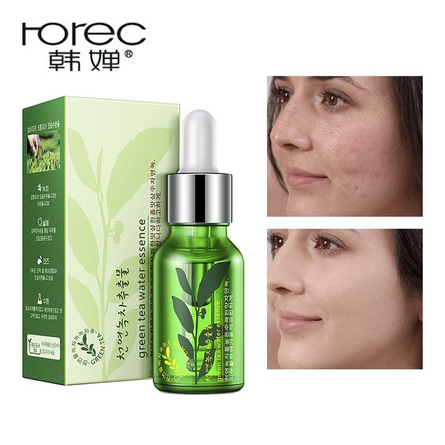 Serum Trà Xanh Chăm Sóc Da Làm Trắng Và Chống Lão Hóa Rorec 15ml