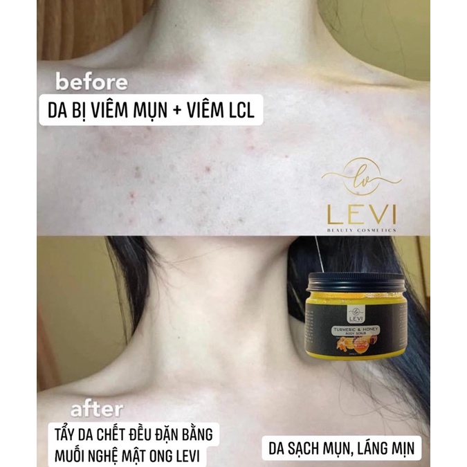 Tẩy Tế Bào Chết Body LEVI Chiết Xuất Muối nghệ mật ong trắng da cao cấp organic dung tích 200ml | BigBuy360 - bigbuy360.vn