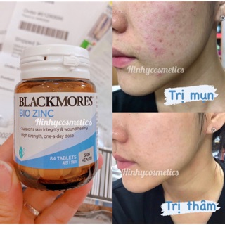 Viên Bio Zinc Blackmores 84v