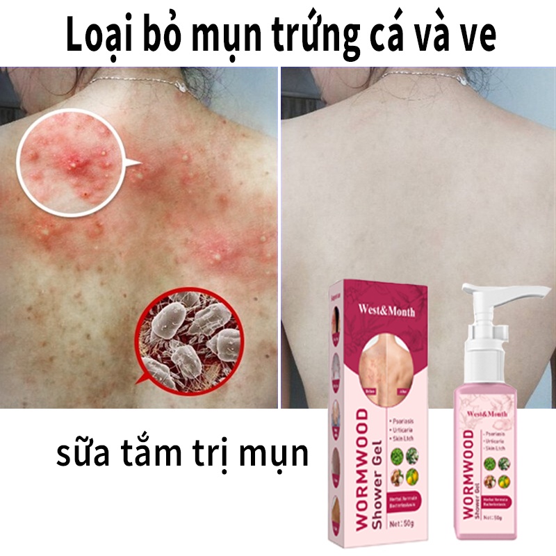 Khử mùi chống ngứa Sữa tắm / làm trắng da / diệt ve / kháng khuẩn cho da