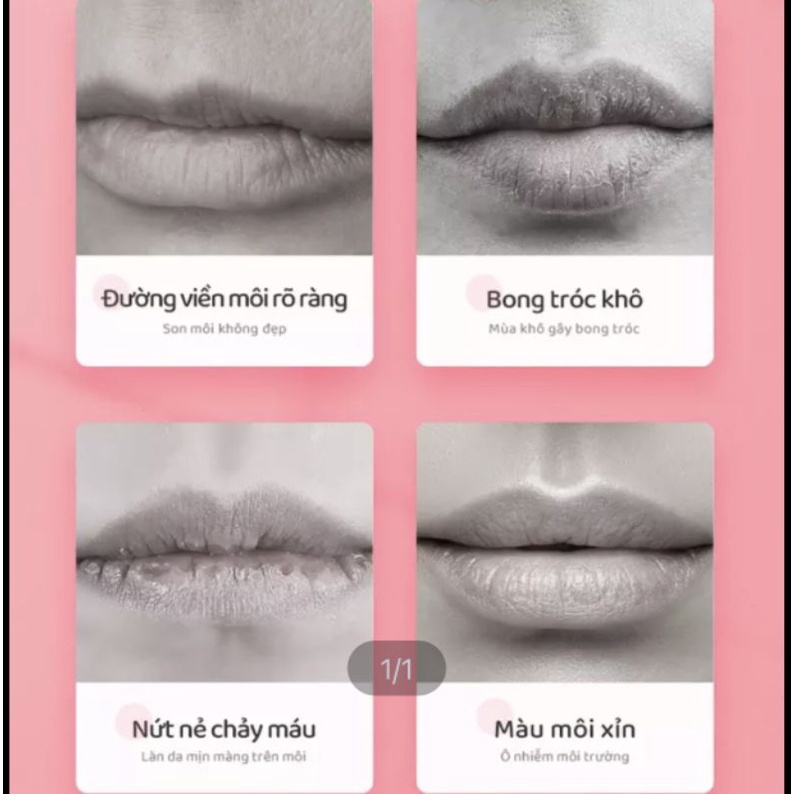 Son Dưỡng Môi Sau Săm- Dưỡng Môi Độc Quyền