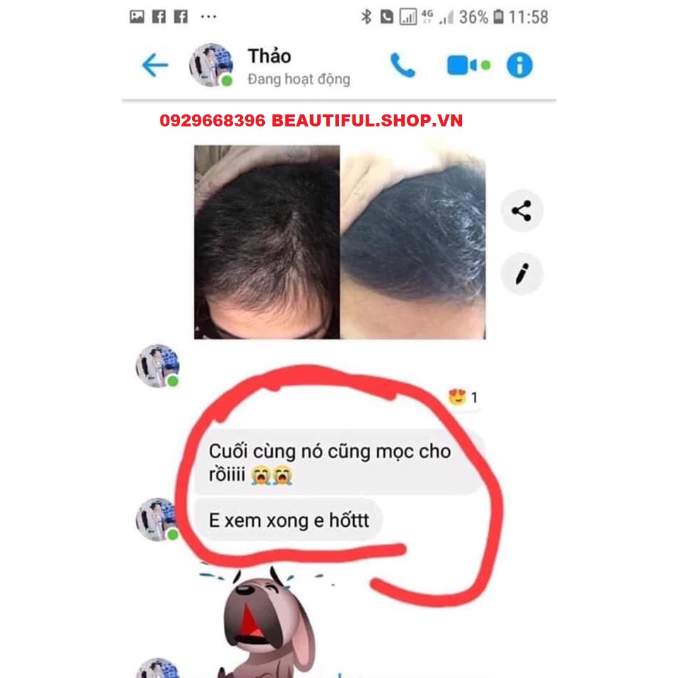 ✔️[100% Chính Hãng] Dầu Gội Dưỡng Tóc Hoa Bưởi MPĐT_Sạch Gầu, Tóc Dày, Tóc Đẹp, Mềm Mại, Hương Thơm Tuyệt Vời | BigBuy360 - bigbuy360.vn