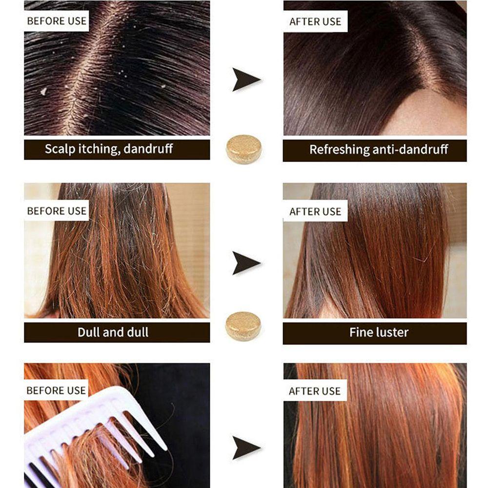 SOFTNESS Xà Phòng Mật Ong Rửa Mặt Chống Rụng Tóc