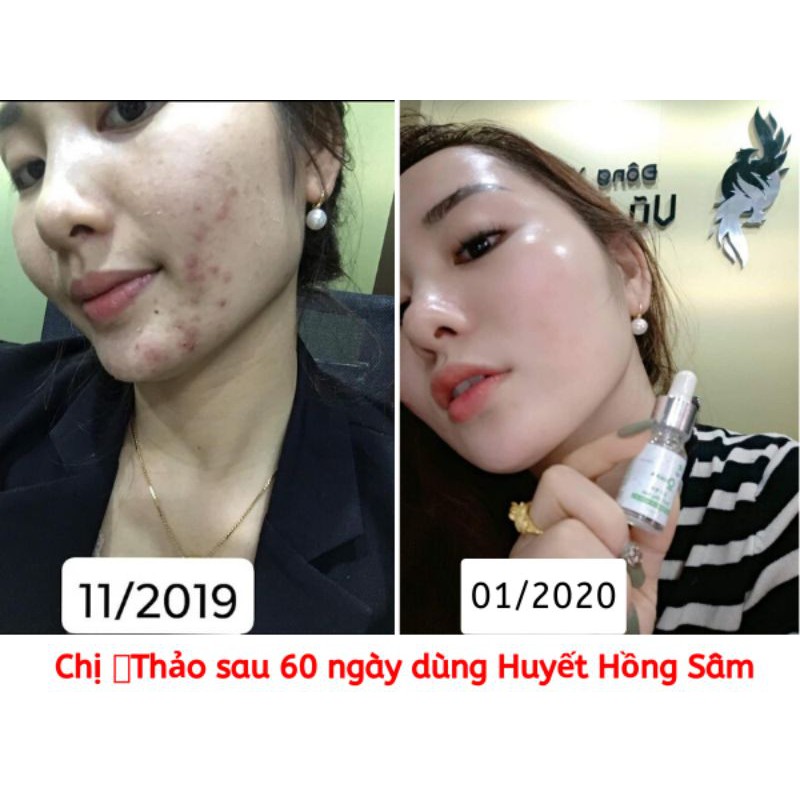 Serum làm giảm mụn, thâm, nám tàn nhang, tái tạo, phục hồi da của Đông Y Vũ Đức Huyết hồng sâm Ohana 10ml | BigBuy360 - bigbuy360.vn