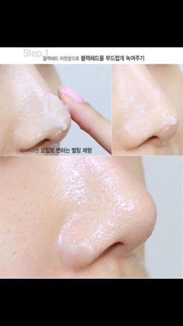 Sáp Tiêu Mụn Đầu Đen Innisfree Jeju