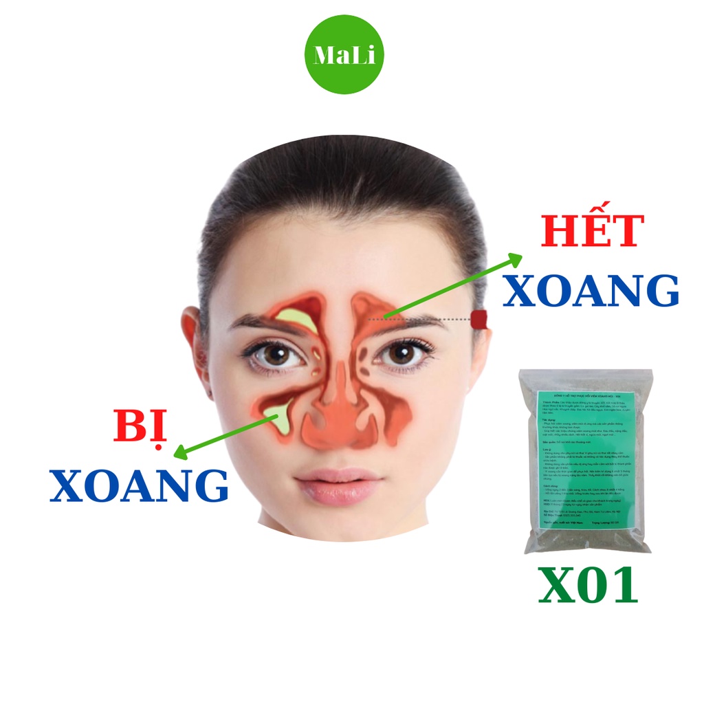 Phục Hồi Xoang Mũi X01 hỗ trợ xoang mũi, 100gr 1 gói, 100% tự nhiên