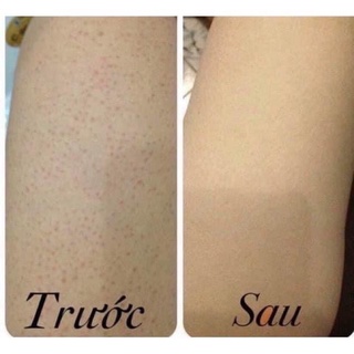 Kem dưỡng sau wax lông Balea