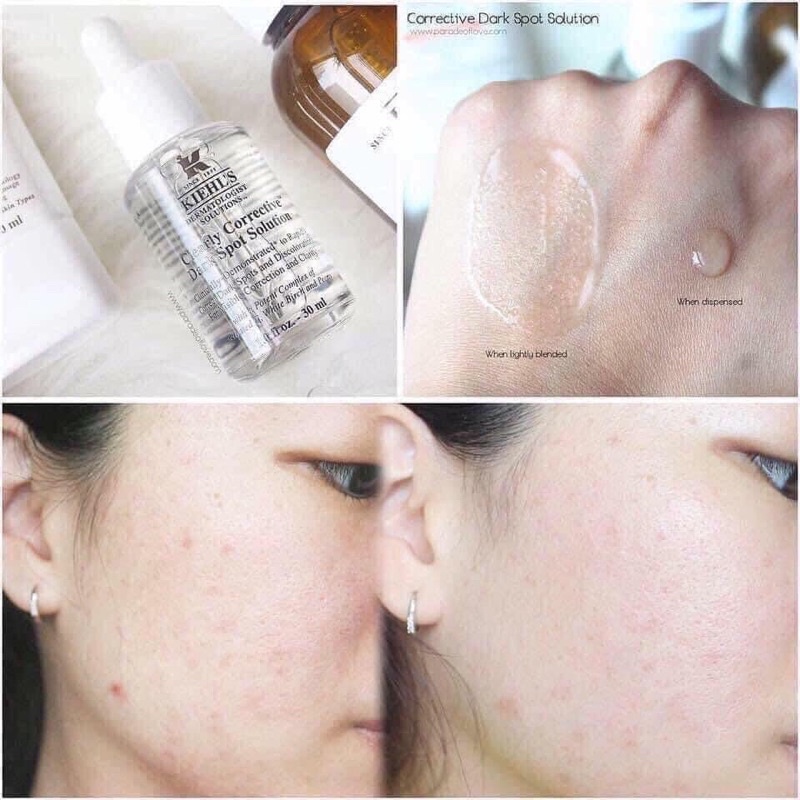 Serum trắng da,mờ thâm,giảm nám Kielhs Clearly Corrective Dark Spot