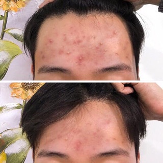 Sữa rửa mặt some by mi aha 30 day chuẩn auth