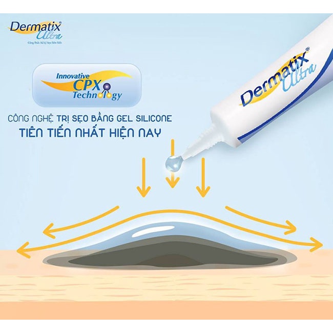 Kem làm mờ sẹo Dermatix Ultra cải thiện Thẹo từ Mỹ - tặng mặt nạ dưỡng da laikou (gói 3gr)