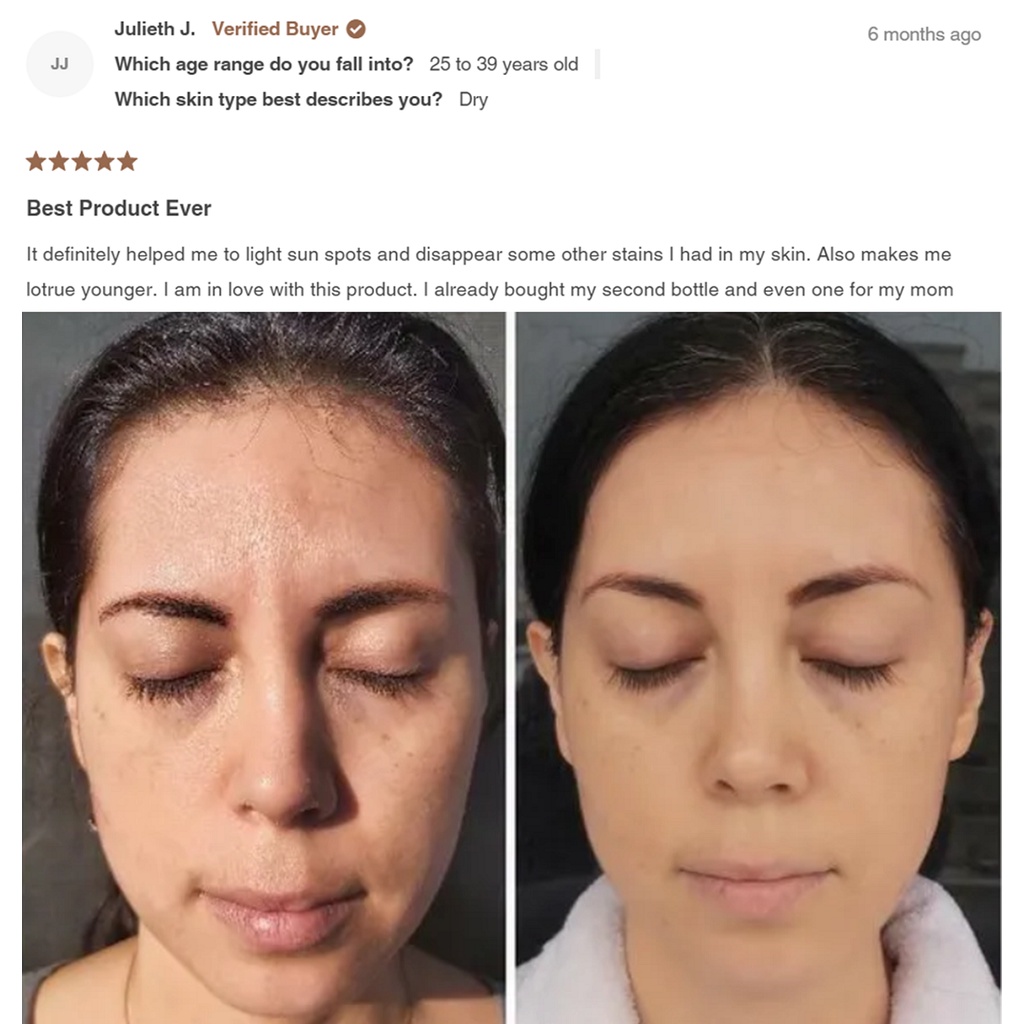 2% Hydroquinone 12% Vitamin C giảm nám thâm xạm cho da bật tone trắng sáng tươi trẻ Simplicity