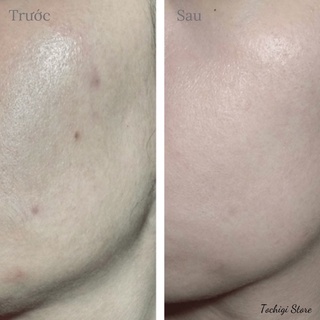 Tinh chất Serum CC melano