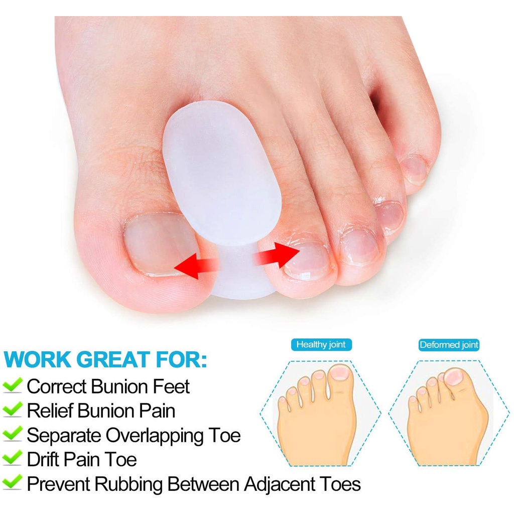 Dụng Cụ Tách Ngón Chân Để Giảm Đau Và Chỉnh Hình