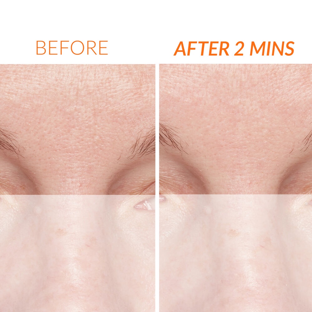 Tẩy Da Chết Kate Somerville ExfoliKate® Intensive Exfoliating Treatment