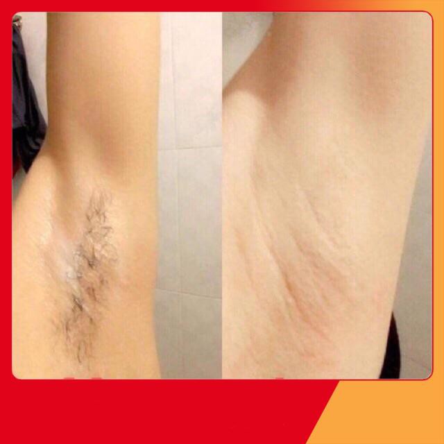 Combo KEM TẨY LÔNG DƯỠNG DA VĨNH VIỄN MAMEN SHOP 120 ML | BigBuy360 - bigbuy360.vn