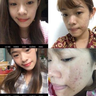 Thảo dược phương anh