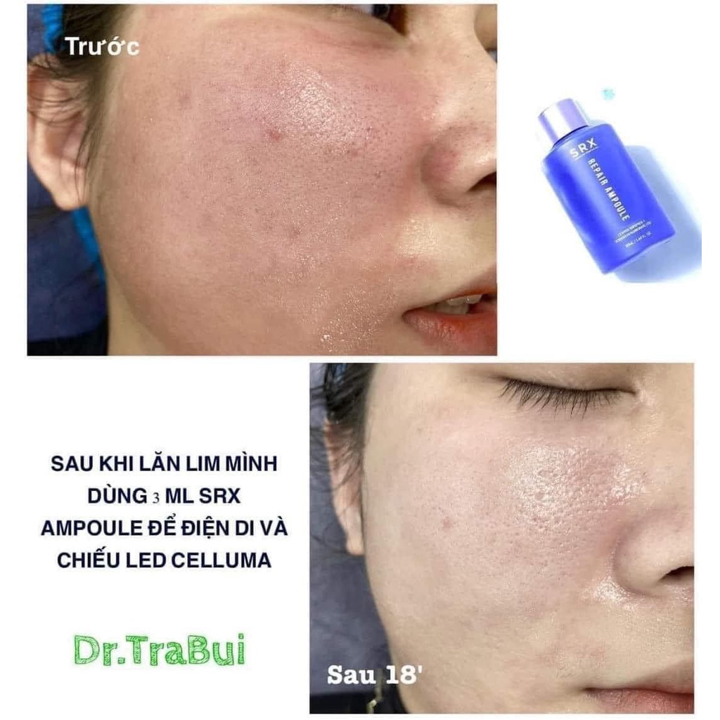 Serum phục hồi SRX REPAIR AMPOULE 50ml -