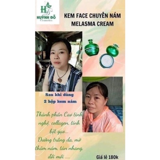 COMBO NÁM HUỲNH ĐỖ( sữa rửa mặt+serum 3w+ kem chuyên nám)