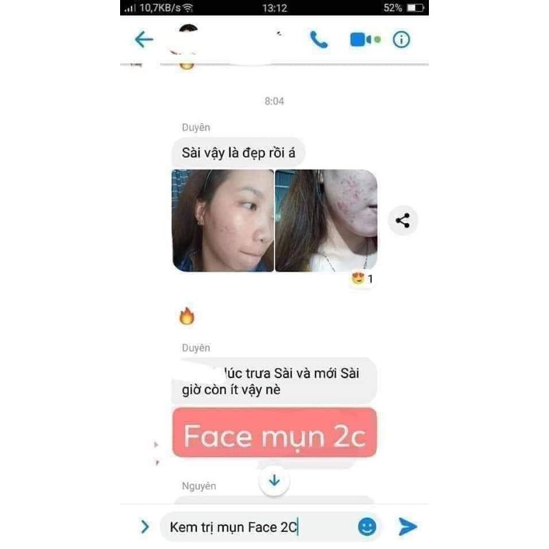 KEM MỤN TRẮNG DA 2C