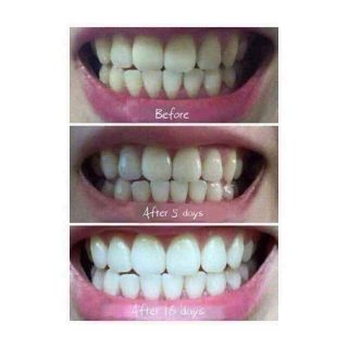 Bột trắng răng T White