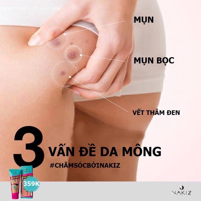 3 TUÝP NAKIZ LIVELY BUTT 〡 Kem thoa thâm Mông, Bẹn, Nách, Lưng, Nhũ hoa, Đầu gối, Cùi chỏ.... Thái Lan