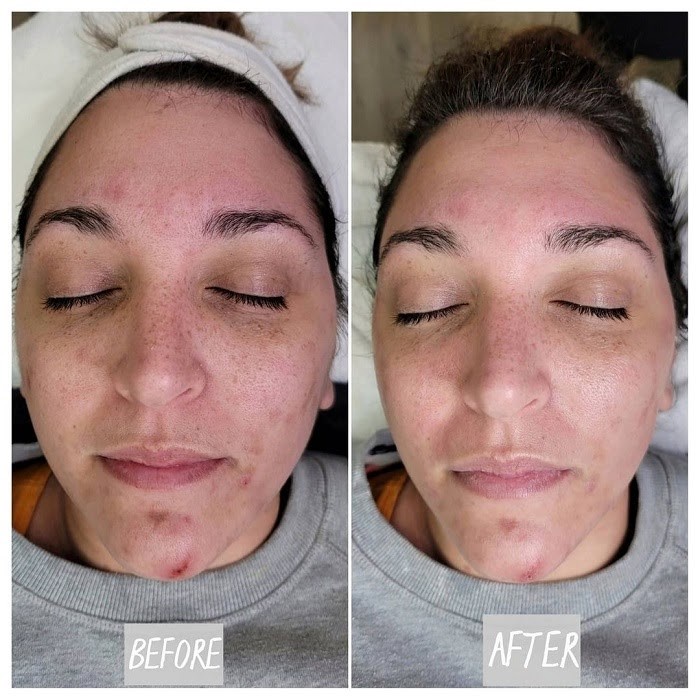 Mặt nạ dưỡng da Image Skincare Ageless Total Resurfacing Masque 57g cho mụn cám - AJA'S SKINLAB
