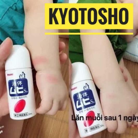 [ free ship ] Lăn Bôi Muỗi Ngứa Muhi 50ml