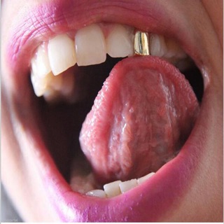 Răng Trang Sức Grillz Giá Rẻ
