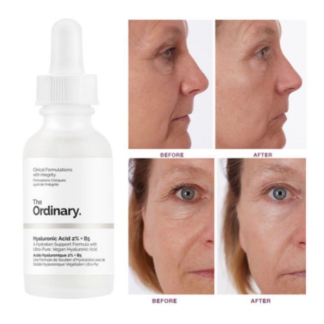 Serum The Ordinary Hyaluronic Acid 2% + B5 Tinh Chất Cấp Ẩm và Phục Hồi Da