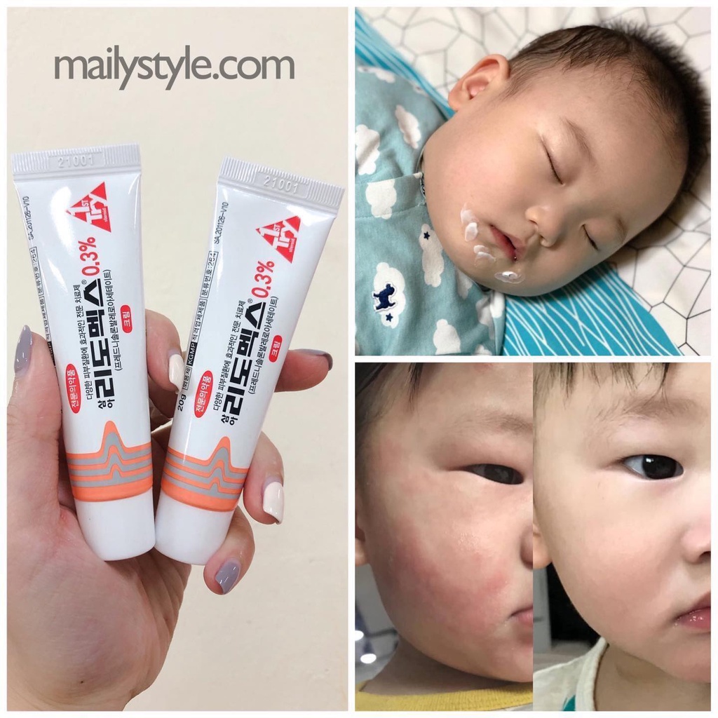 E87_Kem Đa Năng Bôi Ngoài Da Lidomex