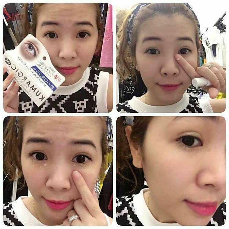 Kem Trị Quầng Thâm Mắt Hadariki Kumargic Eye Cream.