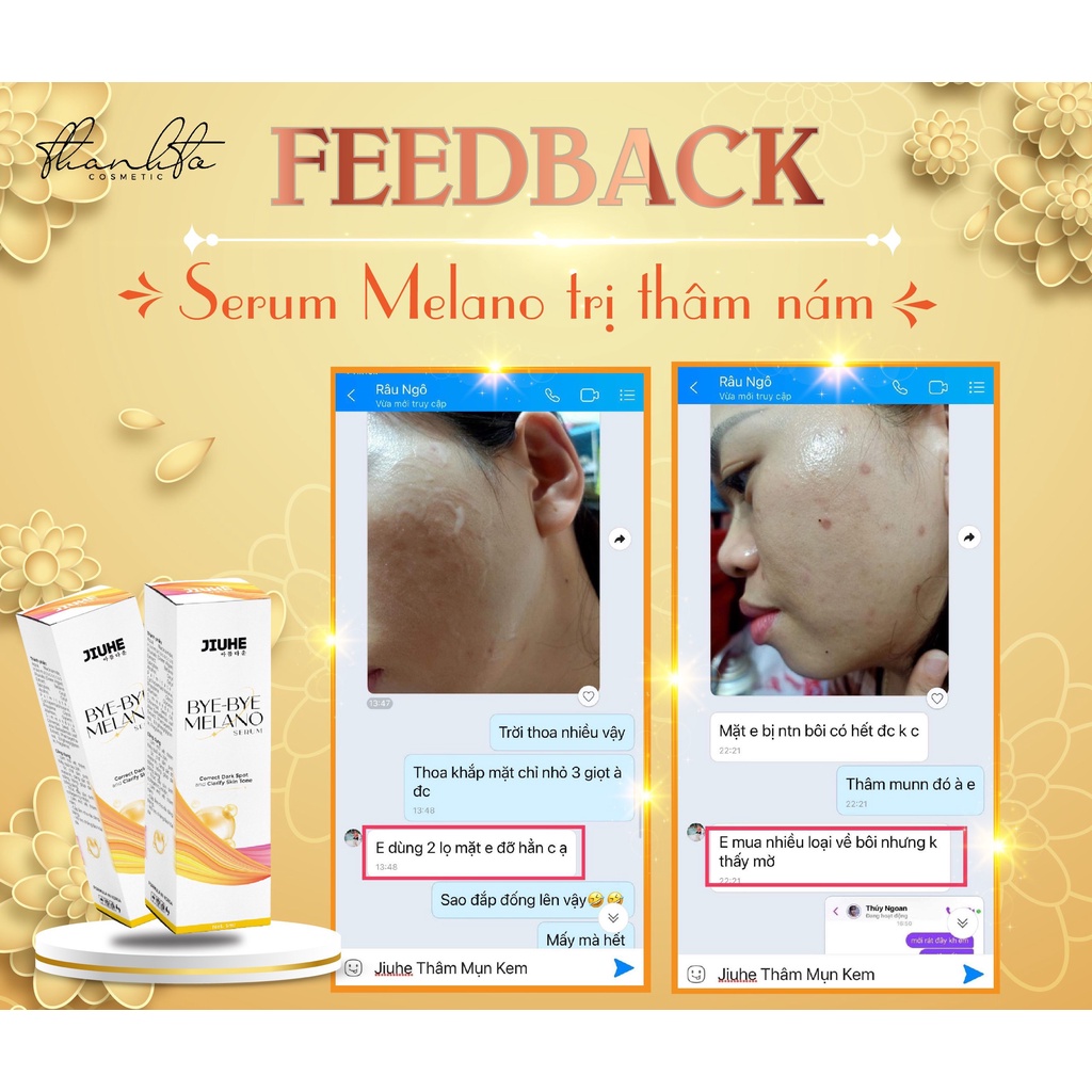 Serum Jiuhe Thâm Bye Bye Melano - Kem Face Jiuhe Thanh Tô - Tinh Chất Dưỡng Serum Jiuhe Mụn Acne Extra