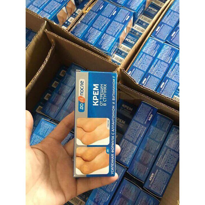 Kem nứt nẻ gót chân Kpem Apteka Nga 50ml | BigBuy360 - bigbuy360.vn