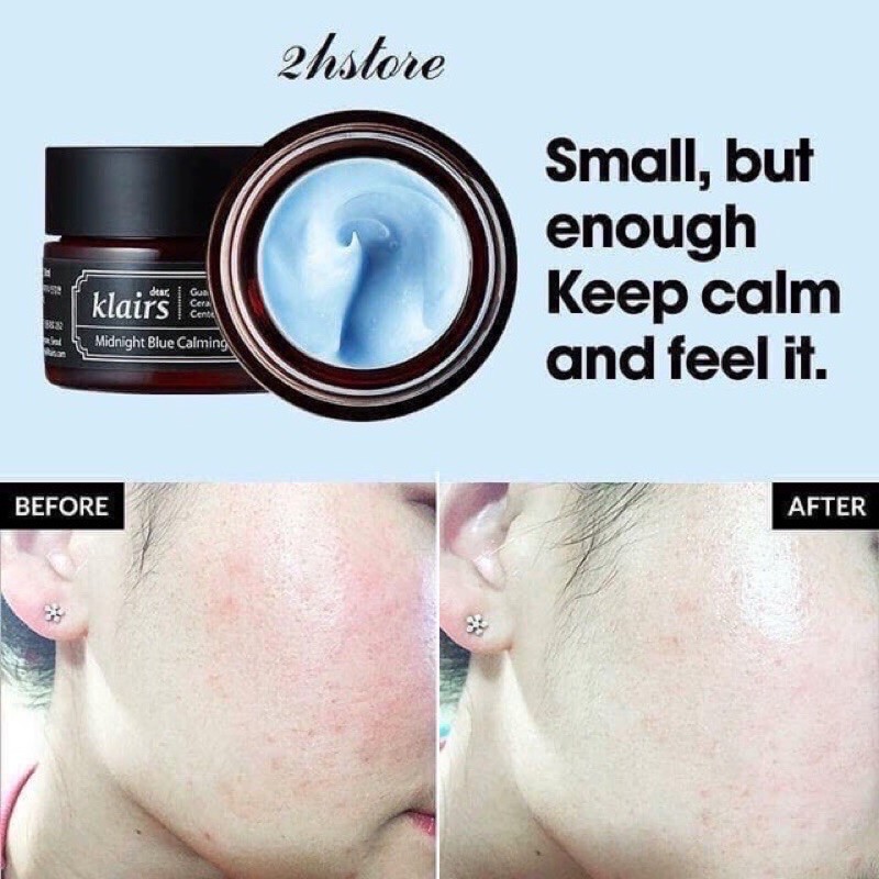 Kem dưỡng Klairs Midnight Blue Calming Cream