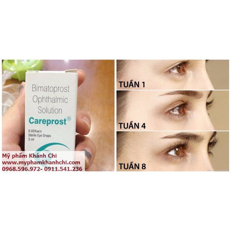 DƯỠNG DÀI MI- ẤN ĐỘ CAREPROST BIMATOPROST OPHTHALMIC SOLUTION