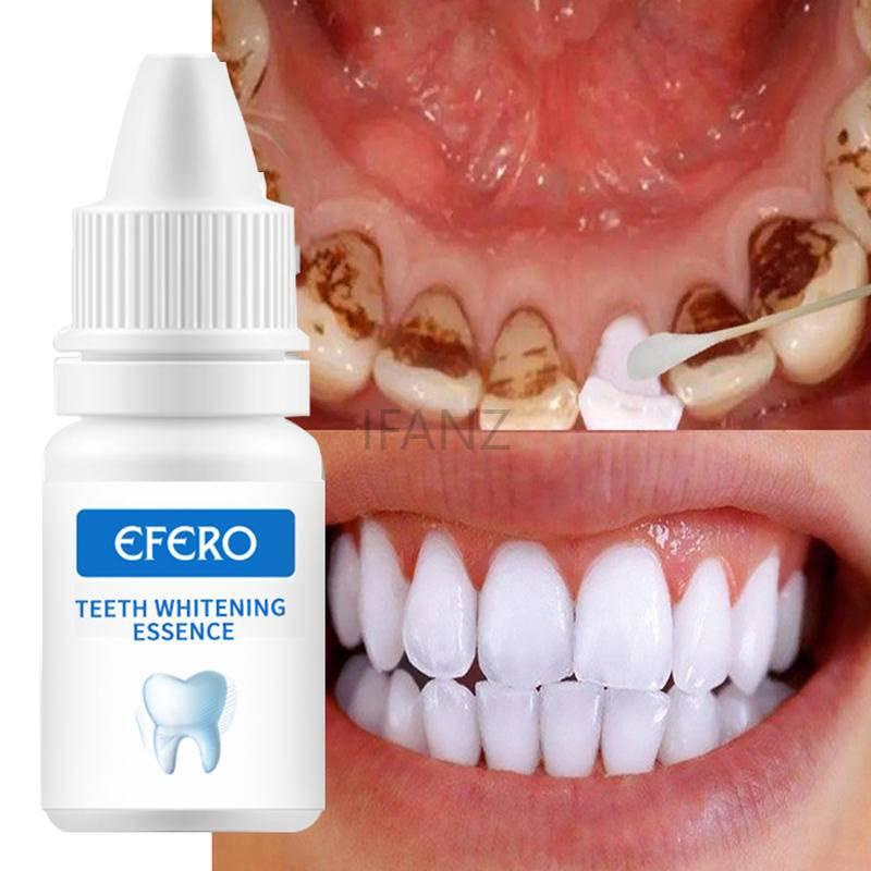 Tinh chất làm trắng răng EFERO loại bỏ vết bẩn hơi thở thơm mát 25ml