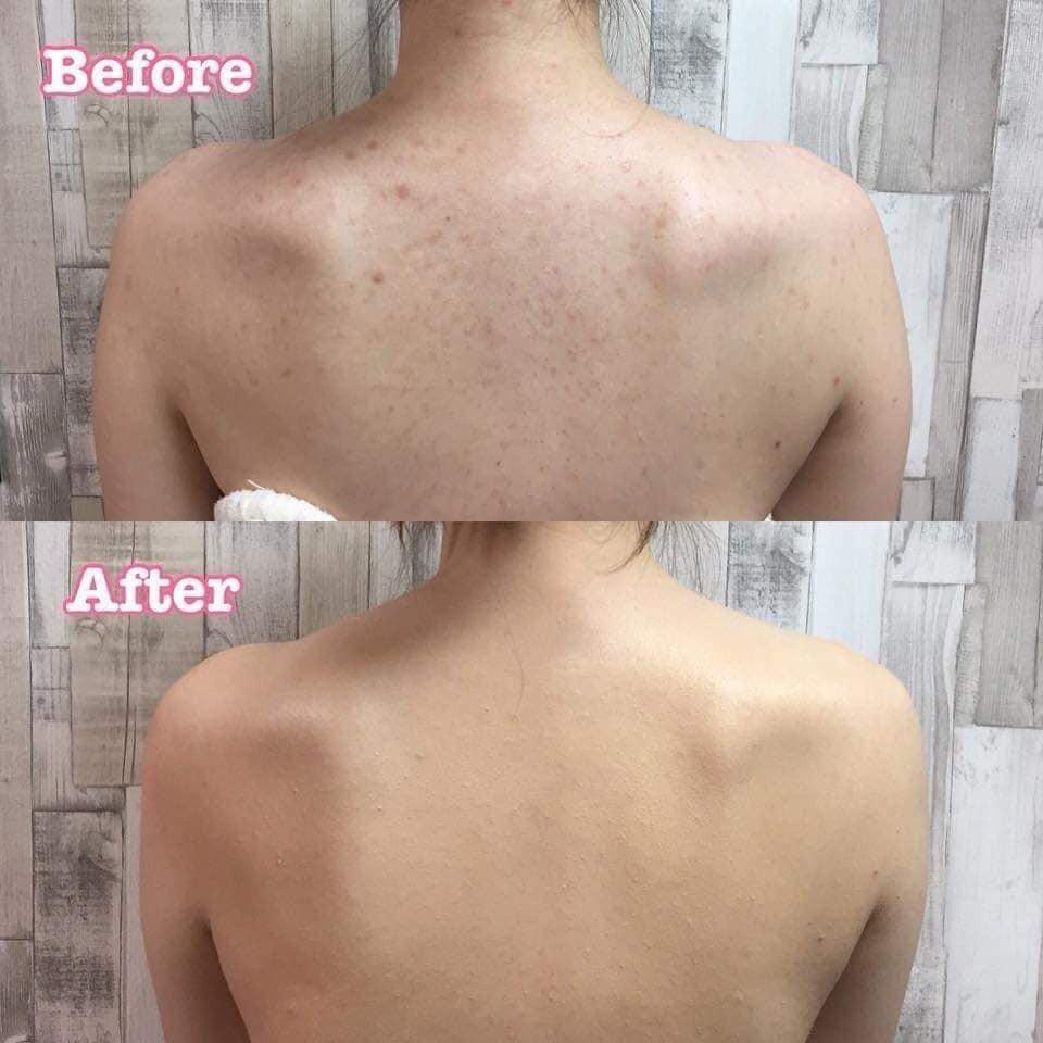 Xà bông ngừa mụn lưng PELICAN For Back Medicated Soap 135g hàng nội địa Nhật Bản - 4976631894225
