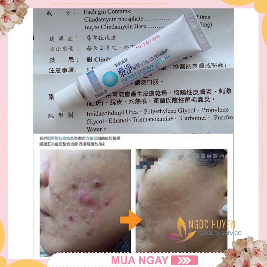 Gel bôi mụn trong suốt cao cấp dermalean ✅