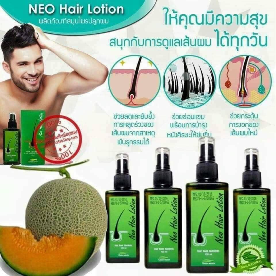 Thuốc mọc tóc NEO HAIR LOTION, Chống hói, chống rụng tóc, chống xơ tóc, kích thích mọc tóc