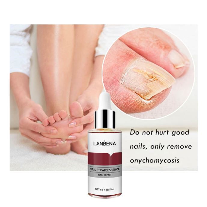 Serum Lanbena Nuôi dưỡng Tái tạo móng - Giải quyết mọi vấn đề về móng tay chân VG