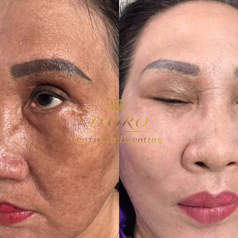 Kem đào thải nám tái tạo da Doro ngày đêm