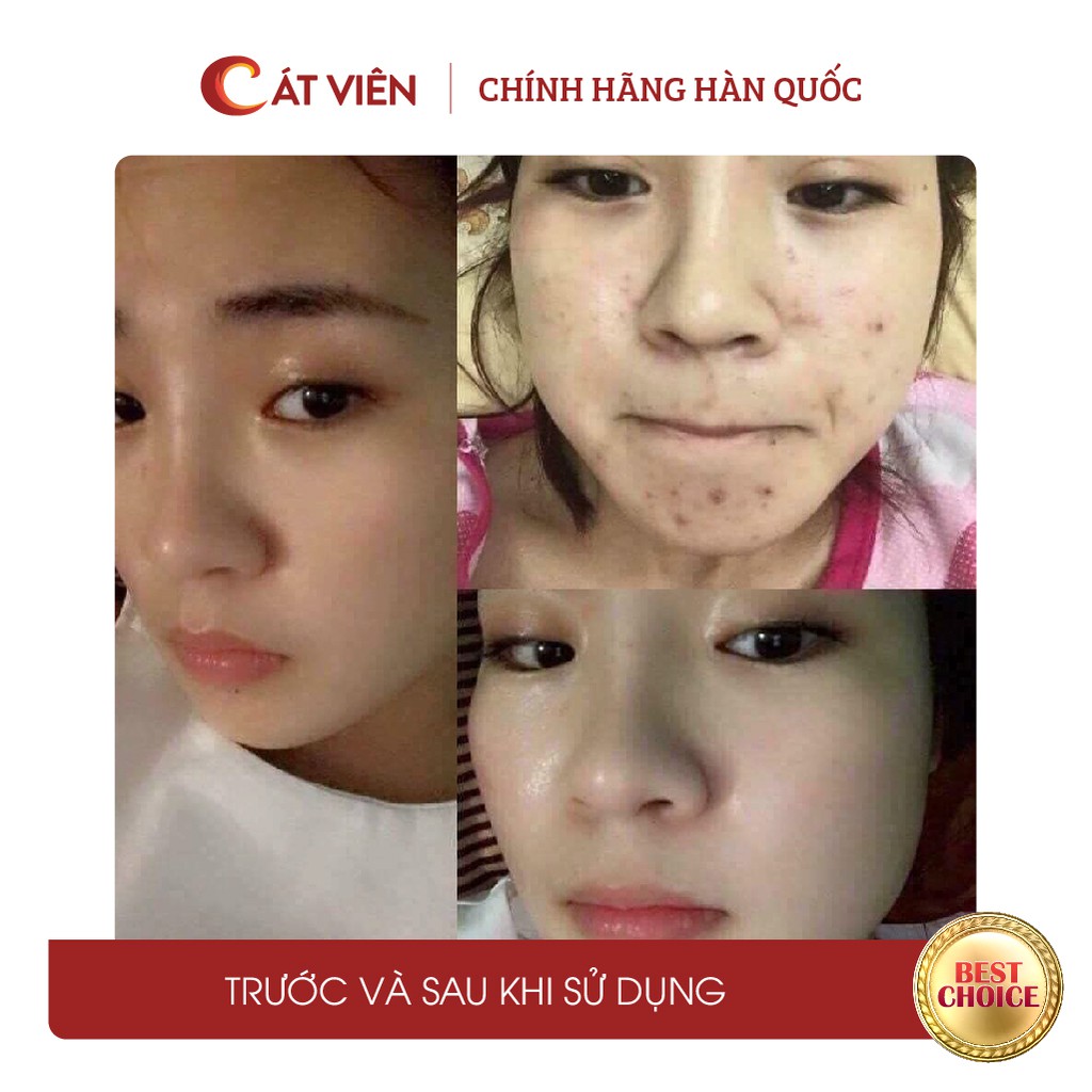 Tế bào gốc serum cá hồi Medicell, dưỡng ẩm làm trắng da mờ thâm sạm, tái tạo sẹo mụn Plantex Extra Salmon - Lọ 6ml | BigBuy360 - bigbuy360.vn