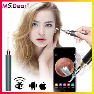 Camera lấy dáy tai thông minh wifi có đèn dùng cho cả android và ios