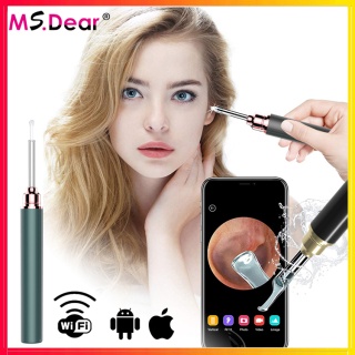 Camera lấy dáy tai thông minh wifi có đèn dùng cho cả android và ios