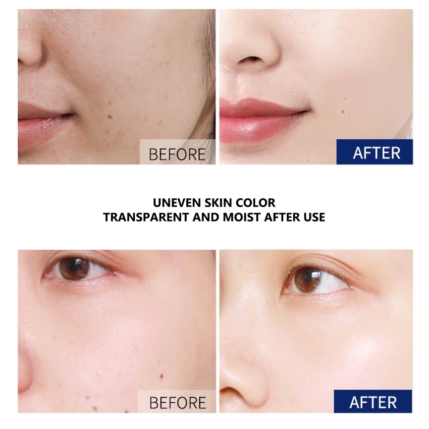 Tinh Chất Vitamin C Làm Trắng Dưỡng Ẩm Chống Oxy Hóa Kiểm Soát Dầu Se Khít Lỗ Chân Lông Chống Lão Hóa HEMEIEL