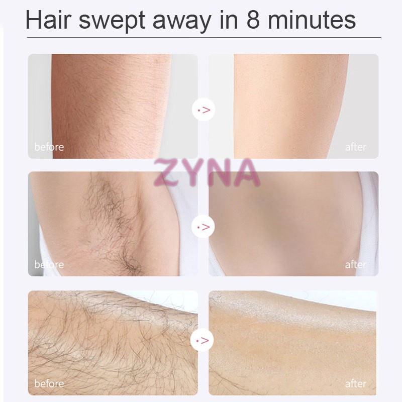 Kem Tẩy Lông Vĩnh Viễn Không Đau Cho Vùng Da Dưới Cánh Tay/Chân