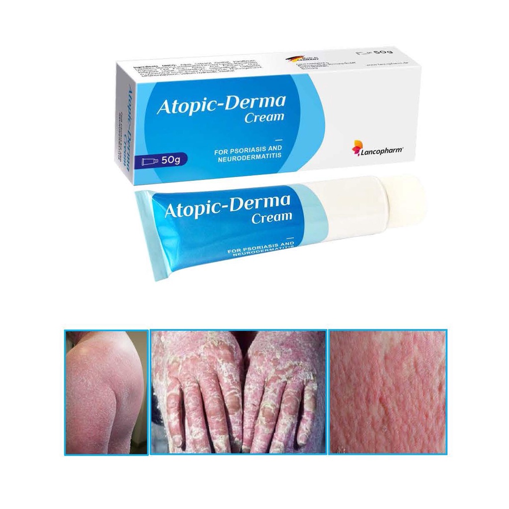 Lancopharm Atopic Derma Cream - Kem cho người bị vảy nến, á sừng, viêm da tuýp 50g