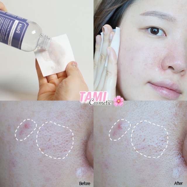 Nước Hoa Hồng Toner Klairs Supple Preparation Unscented / Facial Toner [ Có Mùi / Không Mùi ]