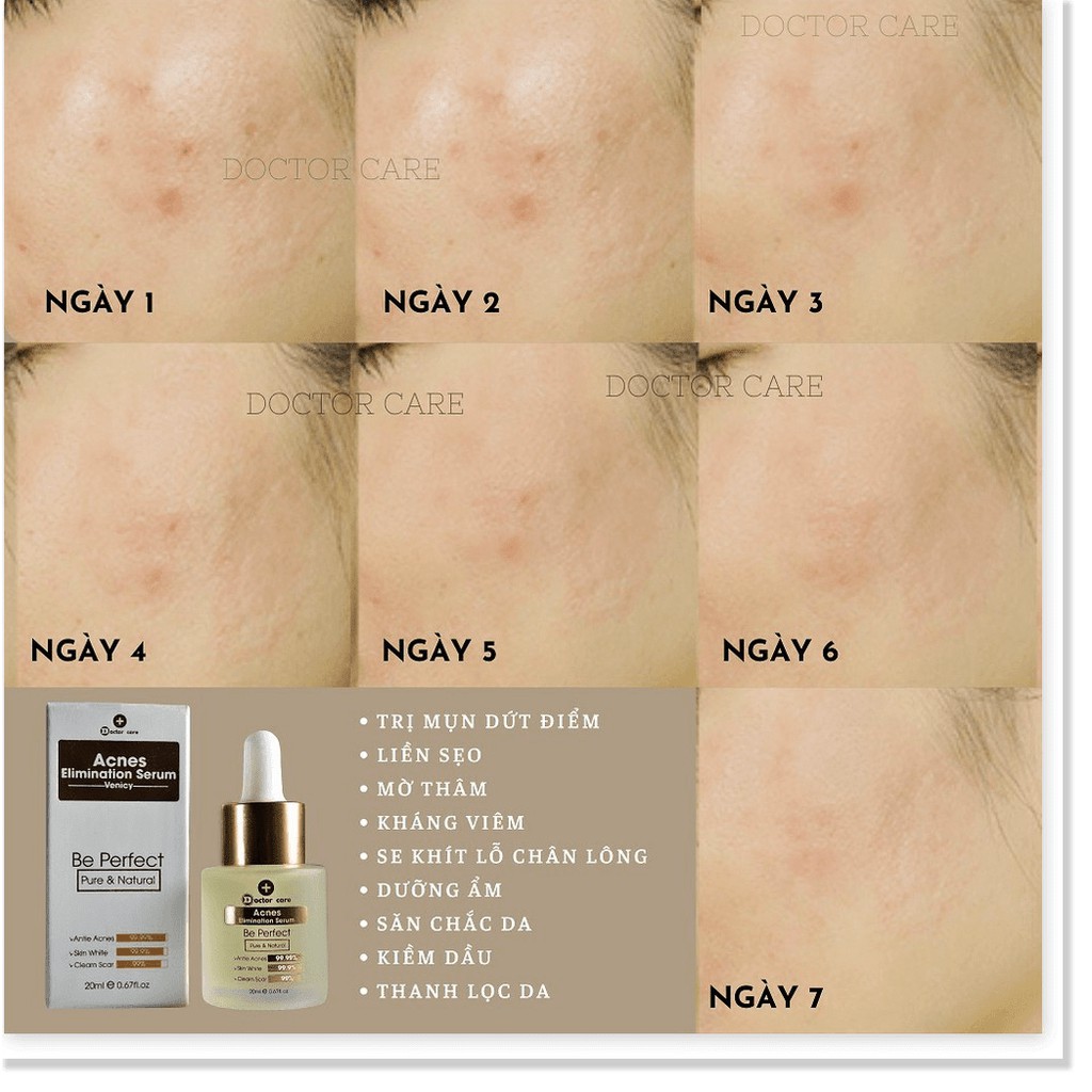 Serum DOCTOR CARE TRI MUN cấp tốc 7 ngay sạch mụn TRANG DA LIEN SEO GIAM THAM | BigBuy360 - bigbuy360.vn