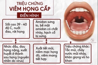 Ho , viêm họng , amidan Cụ Làng Nghè